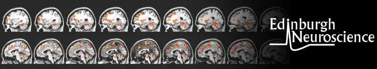 MRI scan 