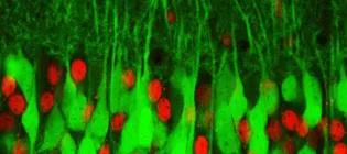 Neurons and cells - female Mosaic