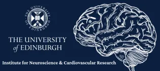 Institute for Neuroscience and Cardiovascular research with University logo and brain graphic