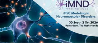 neuron with nucleus and event details