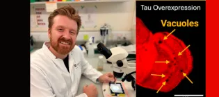man with beard smiling next to telescope as well as an image of a fly with overexpressed tau