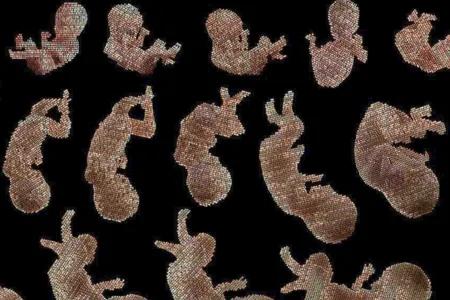 Stages of developing foetus on black background