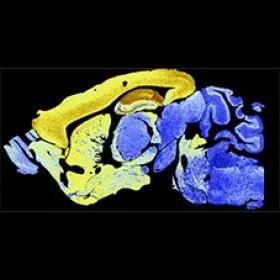 Scan of a brain