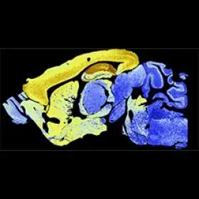 Scan of a brain