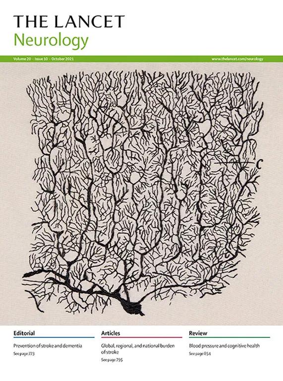embroidery: fully developed cerebellar Purkinje cell