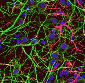 Confocal images or cultured neurones and glia