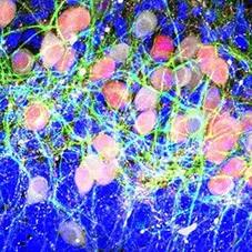 Parkinsons Symposium Square Logo