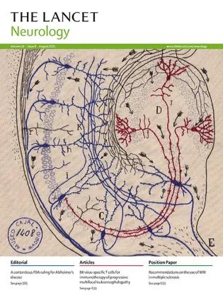 Embroidery of Cajal's hippocampus